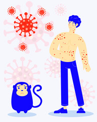 Vector illustration of showing monkey pox outbreak, man showing pain from blisters on skin caused by ingestion of monkeypox virus , flat design.