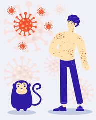 Vector illustration of showing monkey pox outbreak, man showing pain from blisters on skin caused by ingestion of monkeypox virus , flat design.