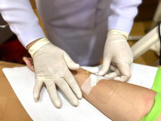 A nurse is collecting a blood sample, using a needle to puncture the vein to give the patient a saline solution.
