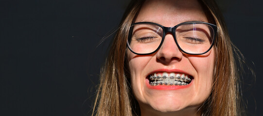 Joyful female with orthodontic brackets. Concept of dentistry.	