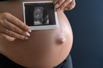 A woman in the third trimester of pregnancy with a visible, large, tense belly, holding an ultrasound photo of her unborn child in her hands. Waiting for labor. Soft focus. - obrazy, fototapety, plakaty