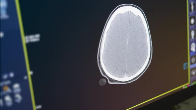 MRI of the brain in sagittal plane with contrast media. magnetic resonance imaging of the brain.