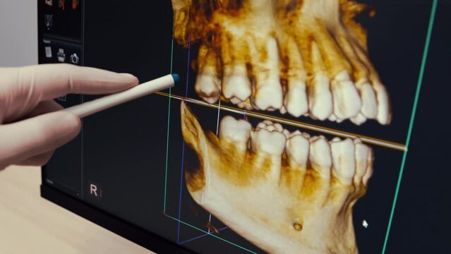 Male dentist examining jaw Xray of 3d skull on computer in clinic