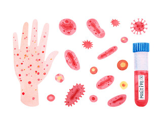 monkeypox virus, hand and beaker with blood
