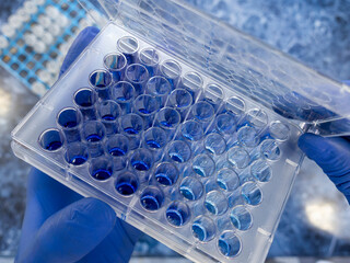 Close-up, the doctor opened the lid of the immunological tablet, the monkeypox antibody test.