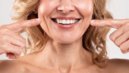 Oral Care. Beautiful Middle Aged Woman Pointing At Her Smile With Fingers