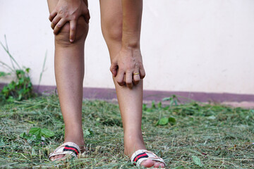 Asian women have itchy legs.
