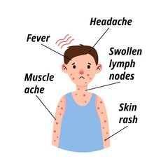 Monkeypox virus symptom infographic on child patient with fever, headache, swollen lymph node, rashes on face, body and back, muscle aches.
