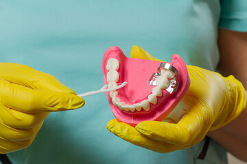 Dentist with floss toothpick and layout of the human jaw. - obrazy, fototapety, plakaty