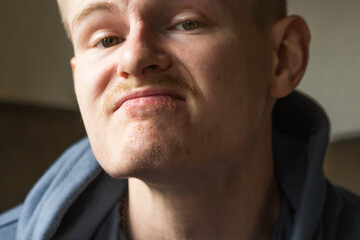 Close up portrait of man's lips infected herpes virus. Painful emotionless look. Skin care and daily hygiene.