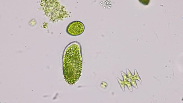 Bacteria and Protozoa in waste water under the microscope.