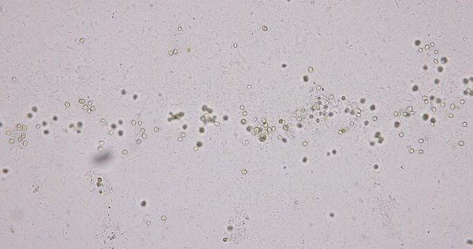 Bacteria and Protozoa in waste water under the microscope.