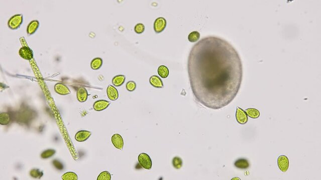 Bacteria and Protozoa in waste water under the microscope.