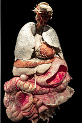 A model of the human entrails, an exhibit for study.