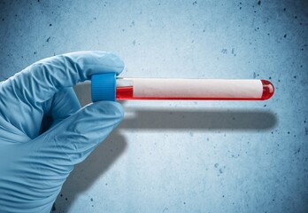 Blood sample for Genetic test, known as mutations,