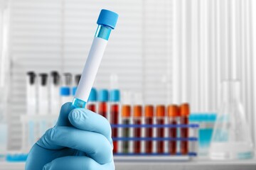 Blood sample of patient for test in laboratory. Doctor with Blood tube test in lab