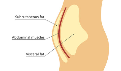 Visceral and subcutaneous fat around waistline. Location of visceral fat in abdominal cavity. Types of human obesity. Medical scheme. Vector illustration isolated on white background.