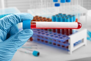 Blood sample of patient for test in laboratory. Doctor with Blood tube test in lab