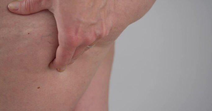 Person hand squeeze fat butt cheek and feeling unhappy with overweight