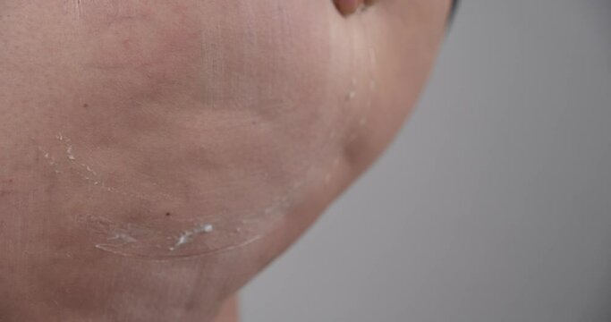 Woman rubbing butt with creme to get rid of cellulite, close up view