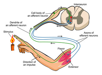 Flexion withdrawal reflex (polysynaptic reflex)
