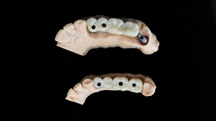two dental prosthesis bridges on beams and models, top view on a black background