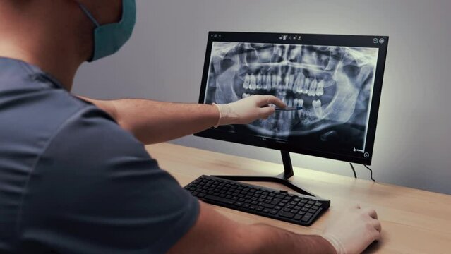 Dentist in a medical mask examines an x-ray image on a computer in a dental office with modern equipment