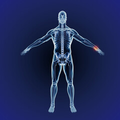 Wrist and inflammation pains. When inflammation strikes. A full length cgi representation of the...