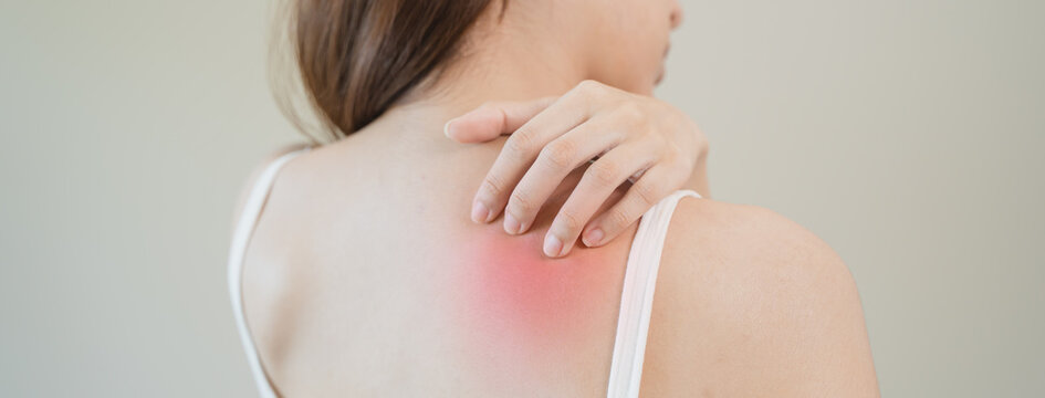 Sensitive Skin Allergic Concept, Woman Itching On Her Back Have A Red Rash From Allergy Symptom And From Scratching.