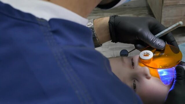 A male pediatric dentist dries a filling with an ultraviolet lamp in the process of filling a little girl. Light-cured filling dried with UV light