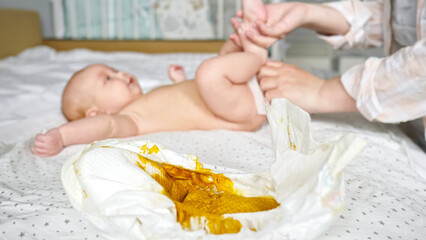 Mother hands clean newborn daughter body with wet wipes after changing dirty diaper. Bare baby girl lies on bed. Selective focus on diaper with baby poop - obrazy, fototapety, plakaty