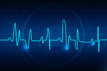 Cardiogram concept -2D rendering illustration