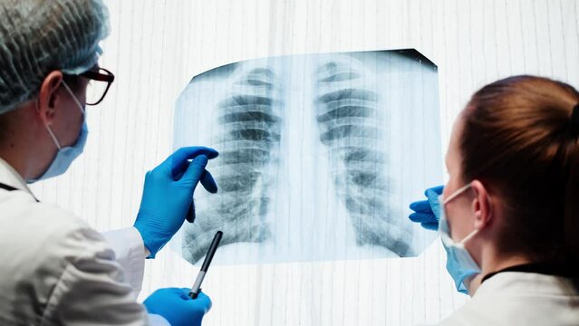 Healthcare and medicine. Doctors examining lungs x-ray close-up. Nurse and therapist looking at ribs roentgen, human chest, checkup. 
