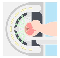 Gamma tumor cancer treat exam body X-ray MRI imaging scan medicine focus disease accelerator central nervous system beam CT Linac linear particle oncology Knife minimally invasive