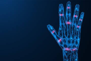 Inflammation and pain in the joints of the hand. Polygonal design of interconnected lines and points. Blue background. - obrazy, fototapety, plakaty