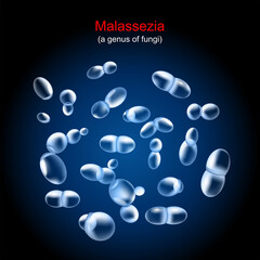 Malassezia. fungus