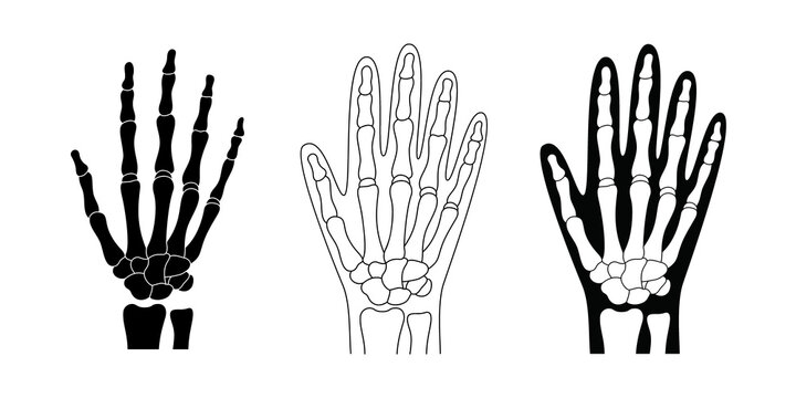 Set of hand skeleton with bones. Black arm silhouette vector illustration