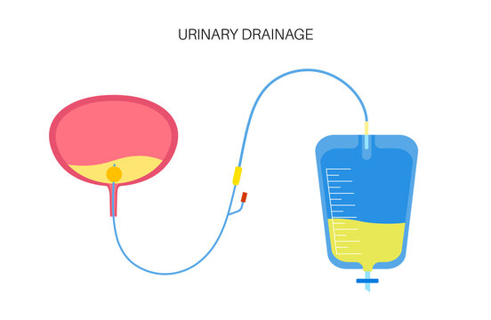 Urinary drainage bag
