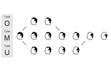 AGA　男性型脱毛症の各タイプと進行ステージのイラスト