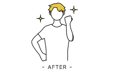 AGA　男性型脱毛症の男性、薄毛が改善されたAGA治療後