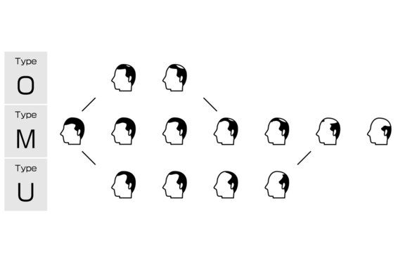 ビフォーアフター Images Browse 3 843 Stock Photos Vectors And Video Adobe Stock