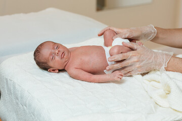 Physiotherapist performing an Ortolani maneuver during a newborn baby hip evaluation.