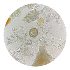Egg of parasite in stool exam.