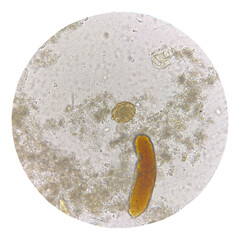 Egg of parasite in stool exam.