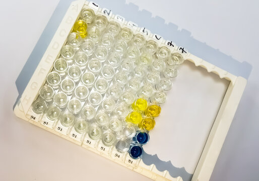 Enzyme-linked Immunosorbent Assay (ELISA) Plate, Immunology Or Serology Testing Method In Medical Laboratory