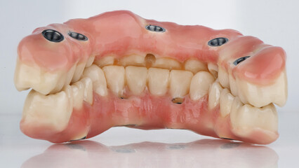 Ceramic prostheses of the whole jaw in bite on a white background, view from the inside