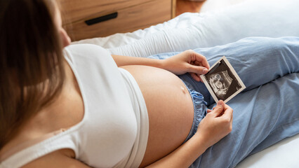 Ultrasound photo pregnancy baby. Woman holding ultrasound pregnant picture. Concept maternity, pregnancy, childbirth.