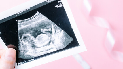 Ultrasound photo pregnancy baby. Woman hands holding ultrasound pregnant picture on pink background. Concept maternity, pregnancy, childbirth.