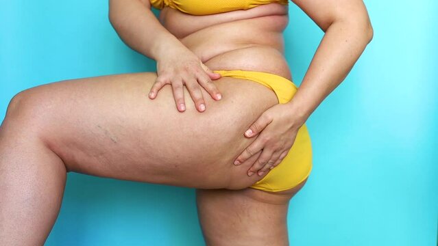 Side view of unrecognizable fat overweight woman wearing yellow bikini, raising leg, massaging thigh with hands on blue background. Body positive, obesity, weight loss, liposuction, unhealthy diet.