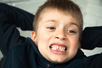 A boy of 6-7 years old shows the first teeth that grow after the loss of milk teeth. Close-up portrait